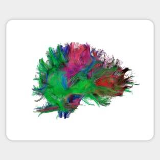 Brain fibres side view right, DTI scan (C038/4665) Sticker